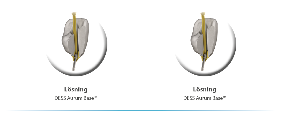 DESS Aurum Base case bild 2