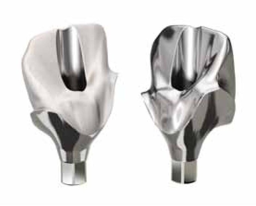 Custom Abutment DESS