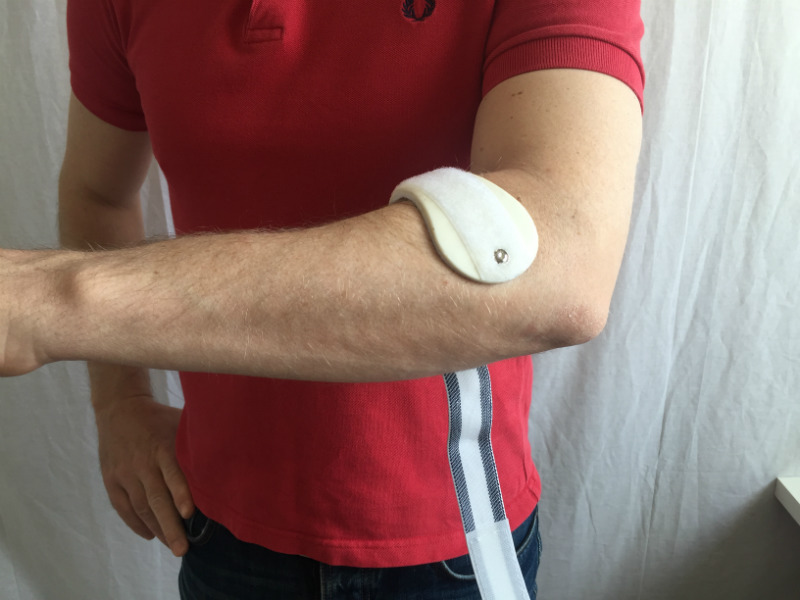 Behandla tennisarmbåge